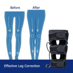 O/X Type Leg Corrector Bowed Knee Valgum Straightening Belt - Image 6