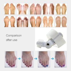 1 Pair Bunion Corrector Toe Separator Big Bone Thumb Protector-FullBodyRelax